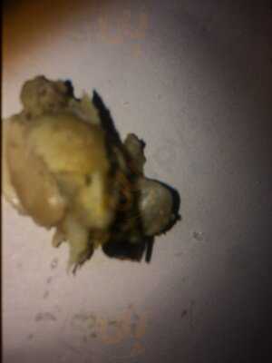 Surrey Hills Fish And Chips