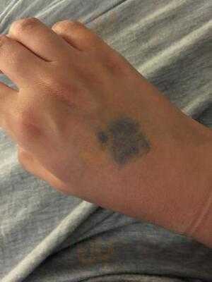 เดโมผับ