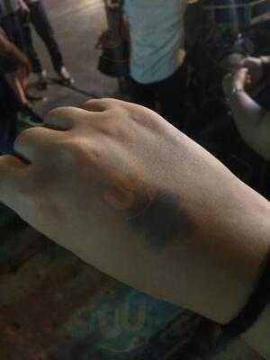 เดโมผับ